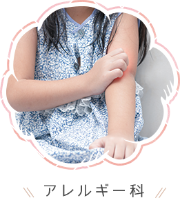 アレルギー科